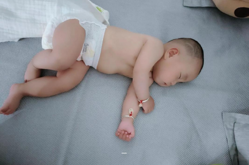 桦甸宝宝黄疸值多少才正常